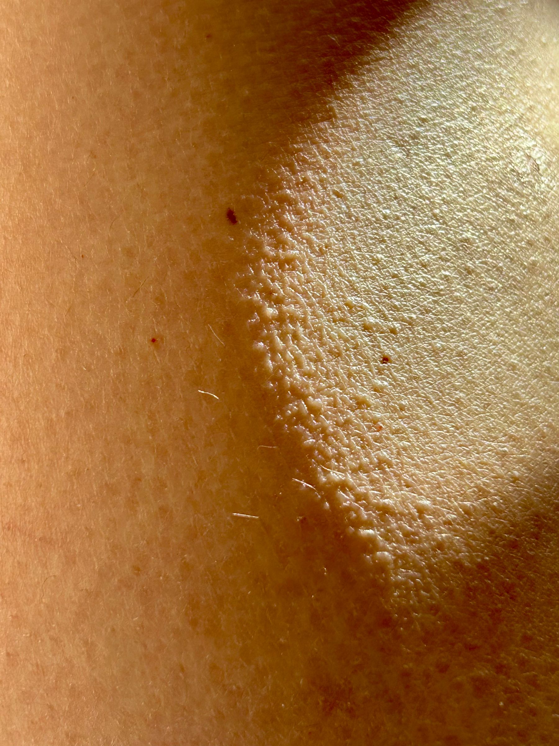 Macro da textura de uma pele saudável e hidratada, à luz natural.